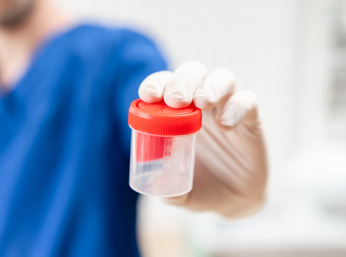 Drug Testing
